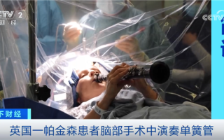 英国一帕金森患者脑部手术中演奏单簧管 医生：手术效果立竿见影！