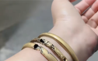 女子给电动车充电大金镯子被电碎：手上肉也被烧黑！