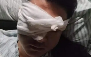 男子除夕夜遭烟花炸伤眼球被摘除：肇事者没找到！