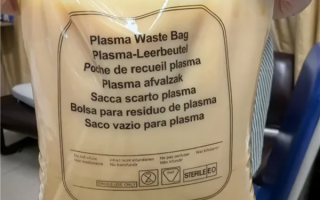 男子一顿大餐后体内滤出7斤油 医生：血脂超标30倍差点没命 ！