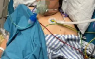 夫妻宰杀活鸭被抓伤 感染鹦鹉热衣原体住进ICU！