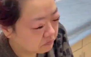 女子吃5斤车厘子过敏肿成悲伤蛙 医生提醒：过量食用所致！