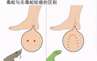 男子夜爬遭蛇咬倒地动弹不得 紧急处理措施来了：一共6点！