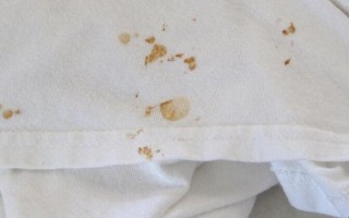白衣服染铁锈的去除方法（去除白衣服上铁锈污渍的技巧）