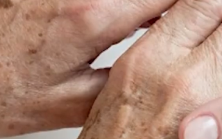 全国爱肝日！00后长期熬夜长出老年斑