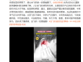 坐飞机害怕的事再+1！重感冒坐飞机可能导致鼓膜穿孔！