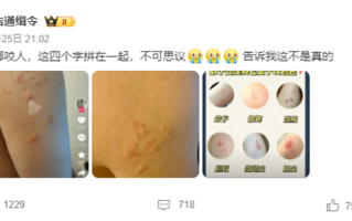 “蟑螂咬人”上热搜 《博物杂志》分析辟谣：三种可能!