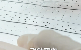 天下武功唯快不破！“95后”女技师凭“飞针”采血走红!
